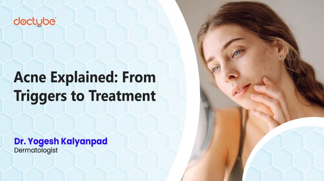 Acne Explained: From Triggers to Treatment